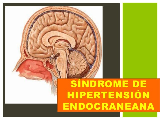 5 maneras de luchar qué es la hipertensión arterial