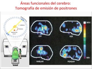 Áreas funcionales del cerebro:  Tomografía de emisión de positrones 
