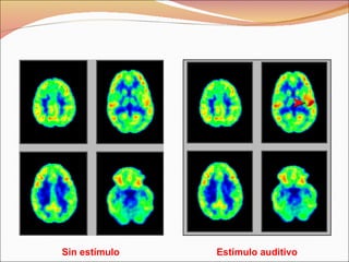 Sin estímulo Estímulo auditivo 