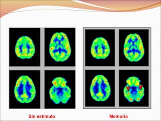 Sin estímulo Memoria 