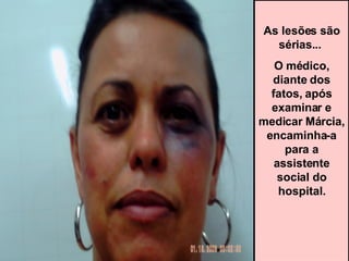 As lesões são sérias...  O médico, diante dos fatos, após examinar e medicar Márcia, encaminha-a para a assistente social do hospital. 