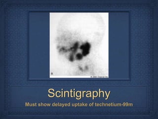 Scintigraphy
Must show delayed uptake of technetium-99m
 