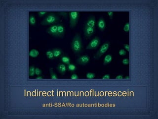 Indirect immunofluorescein
    anti-SSA/Ro autoantibodies
 