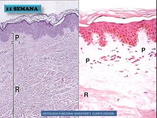 HISTOLOGIA FUNCIONAL WHEATHER`S  CUARTA EDICION. 11 SEMANA 