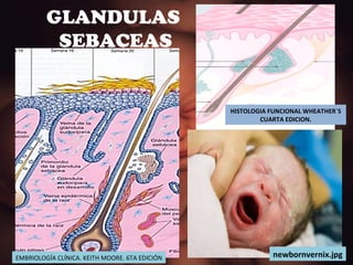 GLANDULAS  SEBACEAS HISTOLOGIA FUNCIONAL WHEATHER`S CUARTA EDICION. EMBRIOLOGÍA CLÍNICA. KEITH MOORE. 6TA EDICIÓN newbornvernix.jpg 
