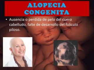 ALOPECIA CONGENITA Ausencia o perdida de pelo del cuero cabelludo, falte de desarrollo del folículo piloso. 