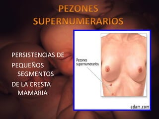 PERSISTENCIAS DE  PEQUEÑOS SEGMENTOS DE LA CRESTA MAMARIA . 