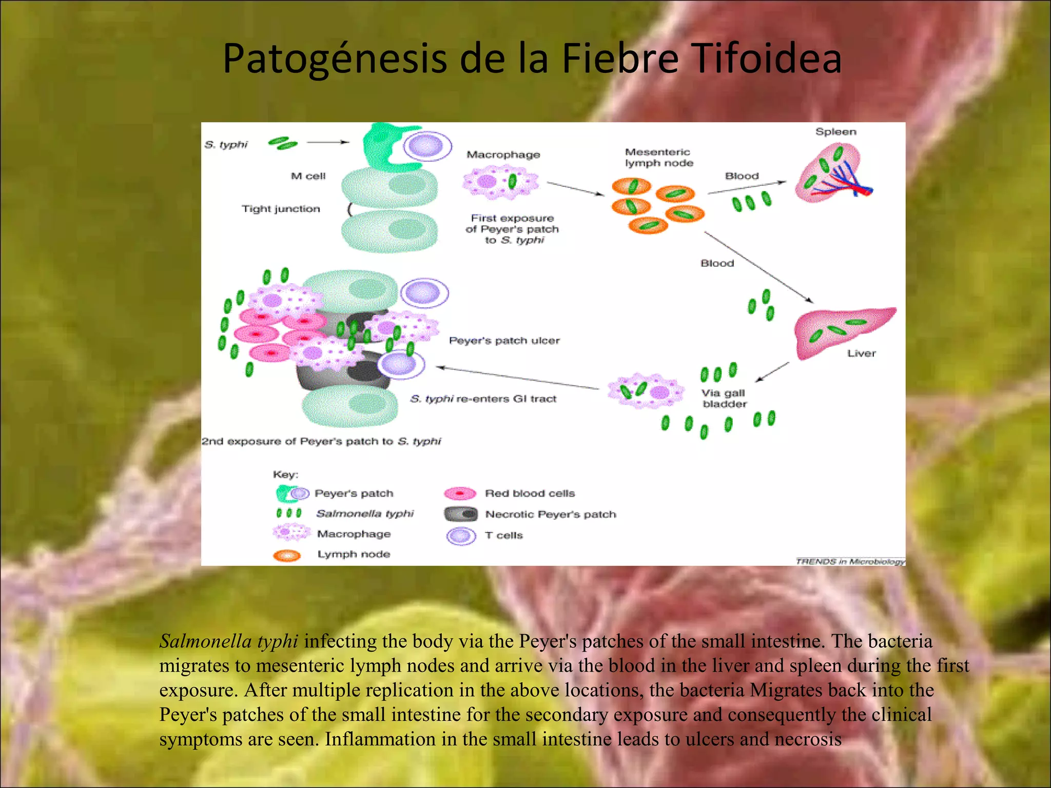 Patogénesis de la Fiebre Tifoidea
Salmonella typhi infecting the body via the Peyer's patches of the small intestine. The bacteria
migrates to mesenteric lymph nodes and arrive via the blood in the liver and spleen during the first
exposure. After multiple replication in the above locations, the bacteria Migrates back into the
Peyer's patches of the small intestine for the secondary exposure and consequently the clinical
symptoms are seen. Inflammation in the small intestine leads to ulcers and necrosis
 