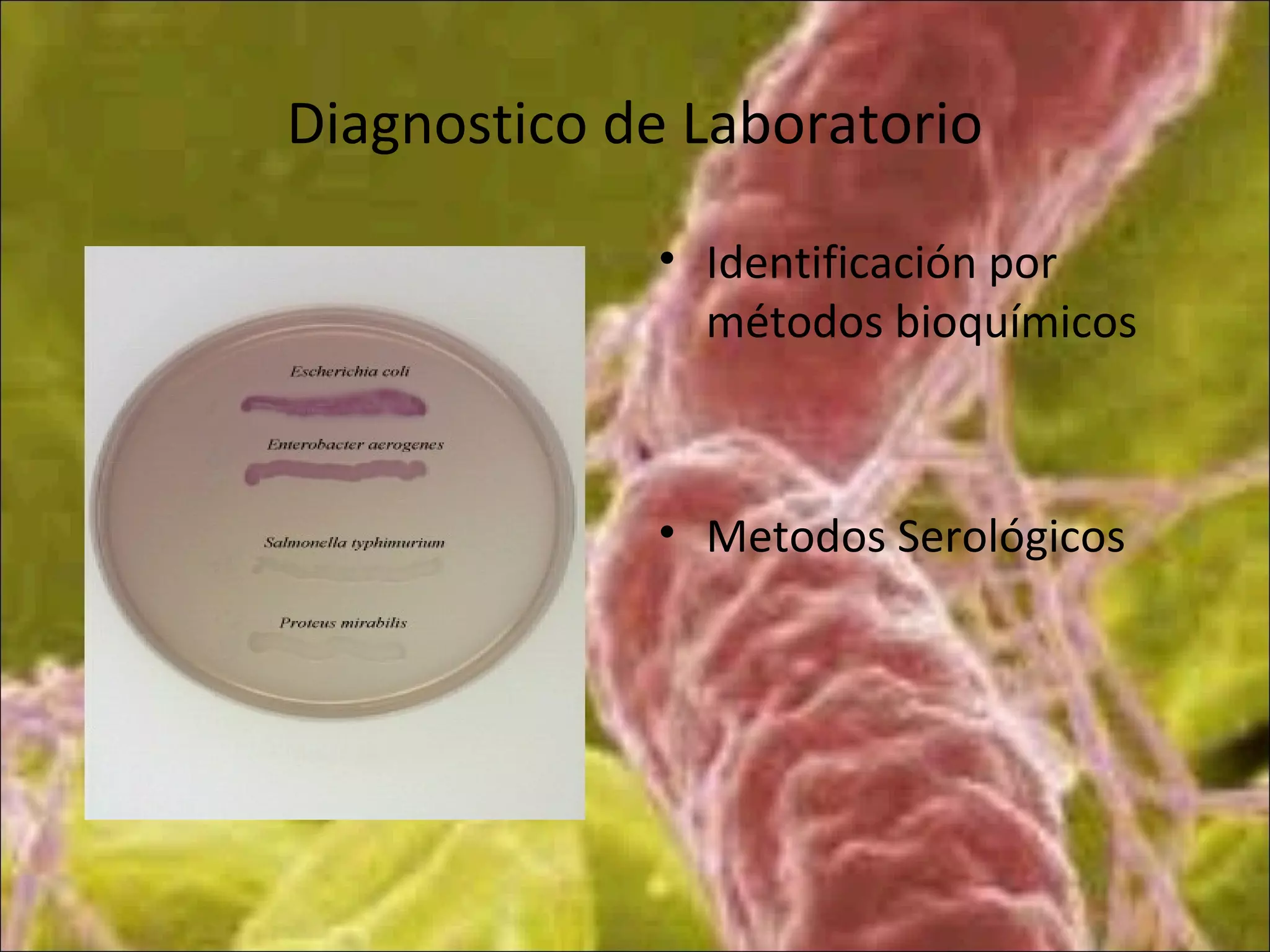 Diagnostico de Laboratorio
• Identificación por
métodos bioquímicos
• Metodos Serológicos
 