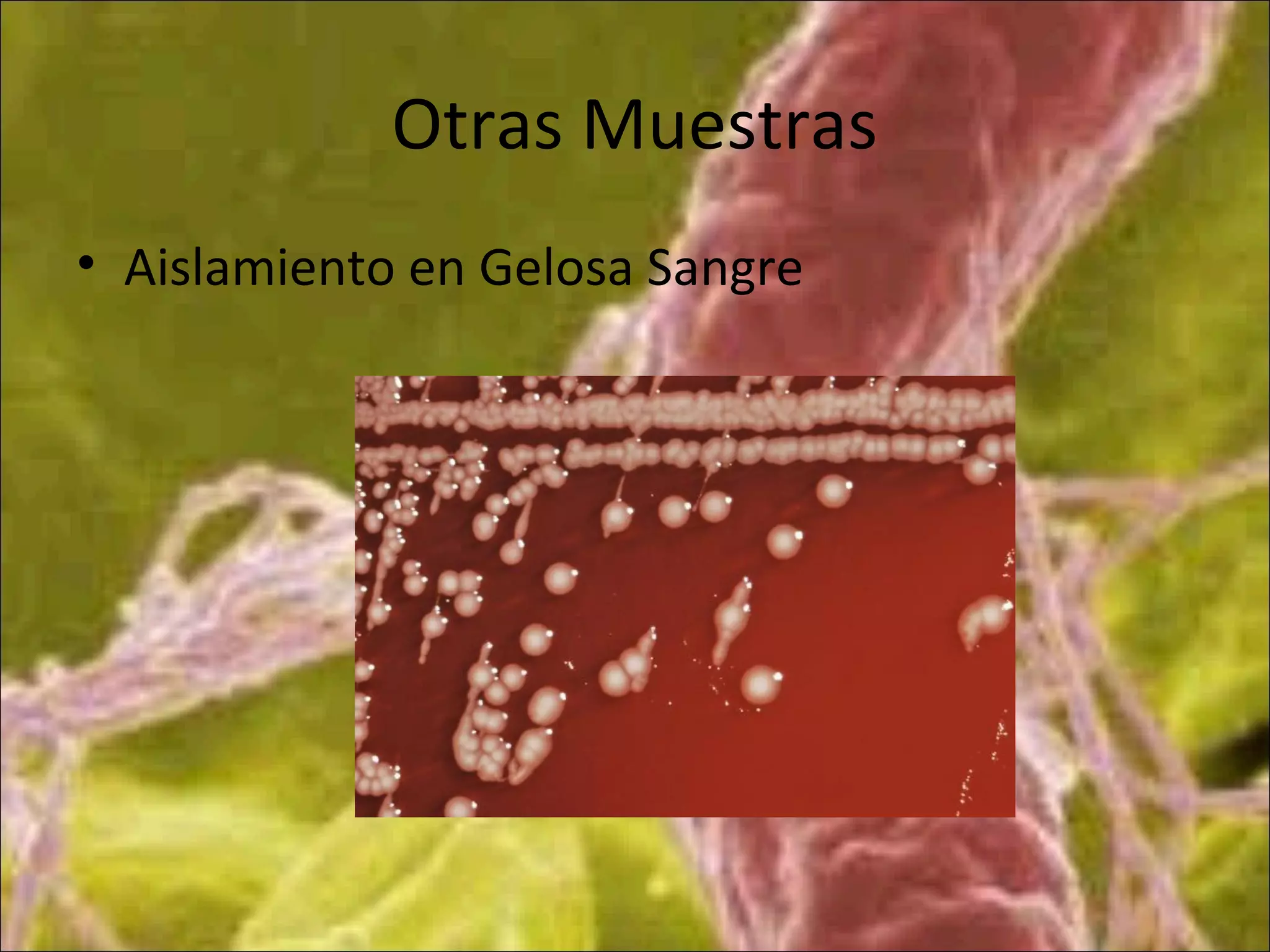 Otras Muestras
• Aislamiento en Gelosa Sangre
 