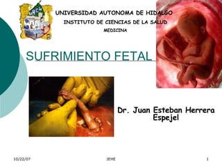 SUFRIMIENTO FETAL Dr. Juan Esteban Herrera Espejel UNIVERSIDAD AUTONOMA DE HIDALGO INSTITUTO DE CIENCIAS DE LA SALUD MEDICINA 