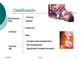 Clasificación  Sufrimiento fetal Crónico  Crónico (B) Crónico Agudo   Potencial  Real  Compensado (adaptación ) No compens...