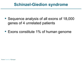 Schinzel-Giedion syndrome Sequence analysis of all exons of 18,000 genes of 4 unrelated patients Exons constitute 1% of human genome 