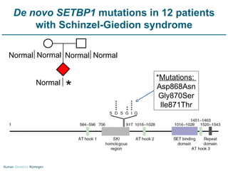 De novo SETBP1  mutations in 12 patients with Schinzel-Giedion syndrome  Normal Normal  *  Normal Normal Normal * Mutations:  Asp868Asn Gly870Ser Ile871Thr 
