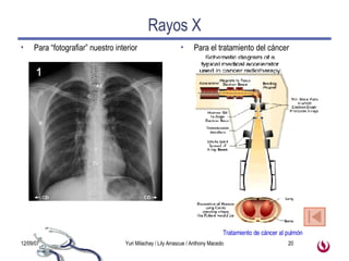 Rayos X Para “fotografiar” nuestro interior Para el tratamiento del cáncer Tratamiento de cáncer al pulmón 