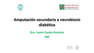 Amputación secundaria a necrobiosis
diabética
Dra. Juana Zavala Ramírez
INR
 