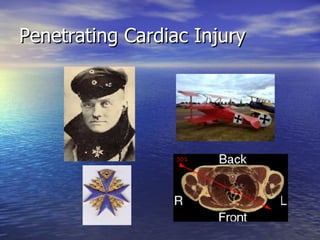 Penetrating Cardiac Injury 