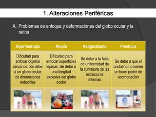 1. Alteraciones PeriféricasProblemas de enfoque y deformaciones del globo ocular y la retina