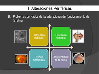 1. Alteraciones PeriféricasProblemas derivados de las alteraciones del funcionamiento de la retina