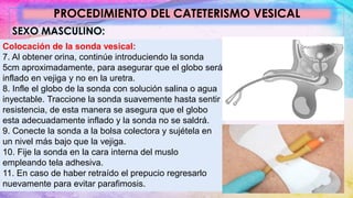 PROCEDIMIENTO DEL CATETERISMO VESICAL
SEXO MASCULINO:
Colocación de la sonda vesical:
7. Al obtener orina, continúe introduciendo la sonda
5cm aproximadamente, para asegurar que el globo será
inflado en vejiga y no en la uretra.
8. Infle el globo de la sonda con solución salina o agua
inyectable. Traccione la sonda suavemente hasta sentir
resistencia, de esta manera se asegura que el globo
esta adecuadamente inflado y la sonda no se saldrá.
9. Conecte la sonda a la bolsa colectora y sujétela en
un nivel más bajo que la vejiga.
10. Fije la sonda en la cara interna del muslo
empleando tela adhesiva.
11. En caso de haber retraído el prepucio regresarlo
nuevamente para evitar parafimosis.
 