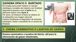 D)ENEMA OPACO O BARITADO
Se emplea para poder realizar un estudio
radiológico completo del intestino con finalidad
diagnóstica gracias a que el bario es un
elemento opaco a los rayos X.
Por tanto, al introducir el bario se obtiene en
la radiografía una imagen clara del
intestino facilitando el diagnóstico de diversas
patologías. Suele ir precedido de un enema de
limpieza.
3.- ENEMA CARMINATIVO O LAVATIVA DE HARRIS:
Enema carminativo o lavativa de Harris: útil para la
eliminación de gases intestinales.
 