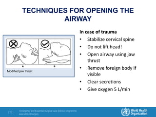 Emergency and Essential Surgical Care (EESC) programme
www.who.int/surgery
17 |
TECHNIQUES FOR OPENING THE
AIRWAY
In case of trauma
• Stabilize cervical spine
• Do not lift head!
• Open airway using jaw
thrust
• Remove foreign body if
visible
• Clear secretions
• Give oxygen 5 L/min
Modified jaw thrust
 