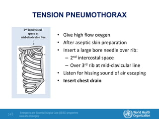Emergency and Essential Surgical Care (EESC) programme
www.who.int/surgery
24 |
TENSION PNEUMOTHORAX
• Give high flow oxygen
• After aseptic skin preparation
• Insert a large bore needle over rib:
– 2nd intercostal space
– Over 3rd rib at mid-clavicular line
• Listen for hissing sound of air escaping
• Insert chest drain
2nd intercostal
space at
mid-clavicular line
 