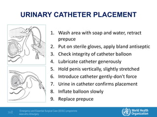 Emergency and Essential Surgical Care (EESC) programme
www.who.int/surgery
38 |
URINARY CATHETER PLACEMENT
1. Wash area with soap and water, retract
prepuce
2. Put on sterile gloves, apply bland antiseptic
3. Check integrity of catheter balloon
4. Lubricate catheter generously
5. Hold penis vertically, slightly stretched
6. Introduce catheter gently-don't force
7. Urine in catheter confirms placement
8. Inflate balloon slowly
9. Replace prepuce
 