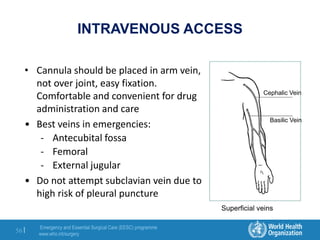 Emergency and Essential Surgical Care (EESC) programme
www.who.int/surgery
56 |
Cephalic Vein
Basilic Vein
Superficial veins
INTRAVENOUS ACCESS
• Cannula should be placed in arm vein,
not over joint, easy fixation.
Comfortable and convenient for drug
administration and care
• Best veins in emergencies:
- Antecubital fossa
- Femoral
- External jugular
• Do not attempt subclavian vein due to
high risk of pleural puncture
 
