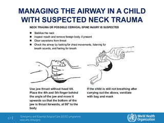 Emergency and Essential Surgical Care (EESC) programme
www.who.int/surgery
67 |
MANAGING THE AIRWAY IN A CHILD
WITH SUSPECTED NECK TRAUMA
 