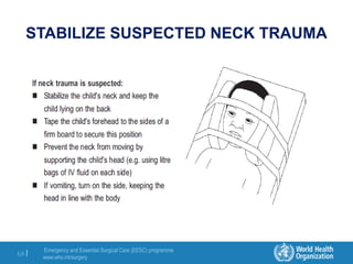 Emergency and Essential Surgical Care (EESC) programme
www.who.int/surgery
68 |
STABILIZE SUSPECTED NECK TRAUMA
 