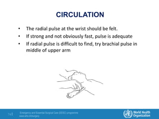 Emergency and Essential Surgical Care (EESC) programme
www.who.int/surgery
74 |
CIRCULATION
• The radial pulse at the wrist should be felt.
• If strong and not obviously fast, pulse is adequate
• If radial pulse is difficult to find, try brachial pulse in
middle of upper arm
 