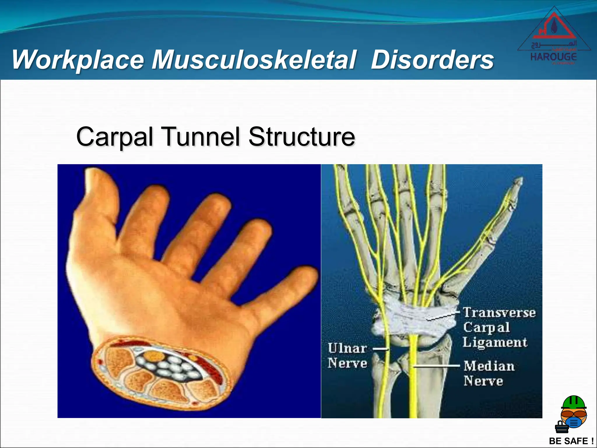 BE SAFE !
Workplace Musculoskeletal Disorders
Carpal Tunnel Structure
 