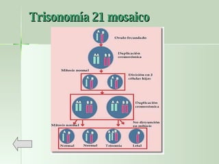 Trisonomía 21 mosaico 