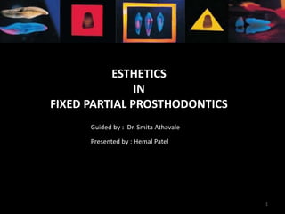ESTHETICS
IN
FIXED PARTIAL PROSTHODONTICS
Presented by : Hemal Patel
Guided by : Dr. Smita Athavale
1
 