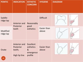 Esthetics in FPD | PPTX