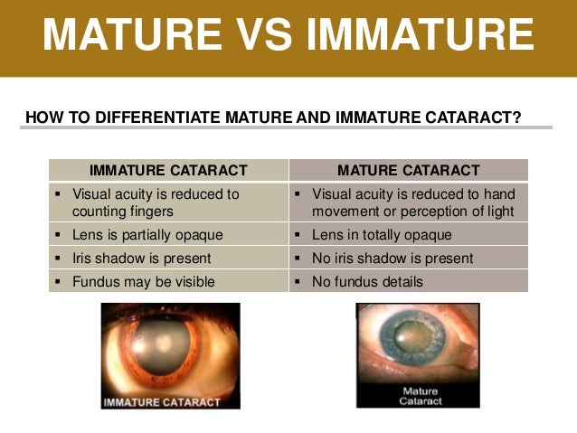 Immature mature vs 14 Signs