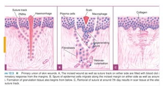 wound healing (prosthodontic implications) | PPTX