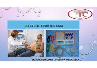 ELECTROCARDIOGRAMA
“
LIC. ENF. ESPECIALISTA YESSICA VALENZUELA L.
 