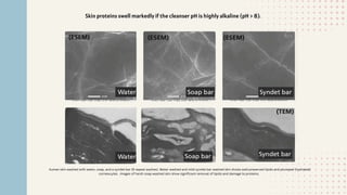 Skin proteins swell markedly if the cleanser pH is highly alkaline (pH > 8).
human skin washed with water, soap, and a syndet bar (9 repeat washes). Water washed and mild syndet bar washed skin shows well‐preserved lipids and plumped (hydrated)
corneocytes. images of harsh soap‐washed skin show significant removal of lipids and damage to proteins.
 