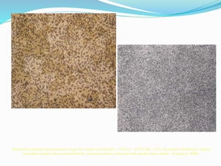 Spheroidize annealed microstructure of type W1 carbon tool steel (Fe - 1.05% C – 0.25% Mn – 0.2% Si) etched with Beraha’s sodium
molybdate reagent which colored both the cementite particles (brownish red) and the ferrite matrix. Original at 1000X.
 