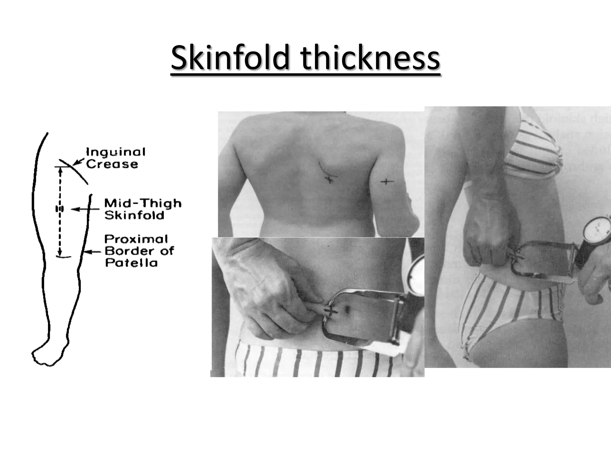 Skin Fold Graph Measurement of obesity | PPTX