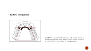 Biomechanical principles in removable partial dentures (rpd) | PPTX