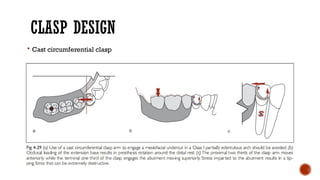 Biomechanical principles in removable partial dentures (rpd) | PPTX
