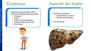 • Geralmente assintomático (45%)
• Sintomas relatados (fase avançada):
• Cansaço;
• Enjoo;
• Pele e olhos amarelados;
• Inchaço abdominal do LD;
• Boca seca.
E
S
T
E
A
T
O
S
E
H
E
P
Á
T
I
C
A
• Aumento de tamanho
• Geralmente no Lobo D
• Bordas arredondadas
• Cor amarelada
 