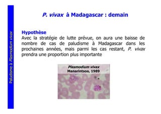 P. vivax à Madagascar : demain


                               Hypothèse
Paludisme à Plasmodium vivax




                               Avec la stratégie de lutte prévue, on aura une baisse de
                               nombre de cas de paludisme à Madagascar dans les
                               prochaines années, mais parmi les cas restant, P. vivax
                               prendra une proportion plus importante

                                                    Plasmodium vivax
                                                   Manarintsoa, 1989
 