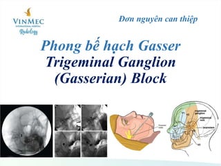 Phong bế hạch Gasser
Trigeminal Ganglion
(Gasserian) Block
Đơn nguyên can thiệp
 