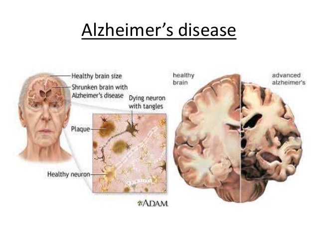Acute Disease Examples List Acute Inflammation Aerobes And 