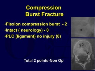 S4_Classification-Thoracolumar-Spine.pptx