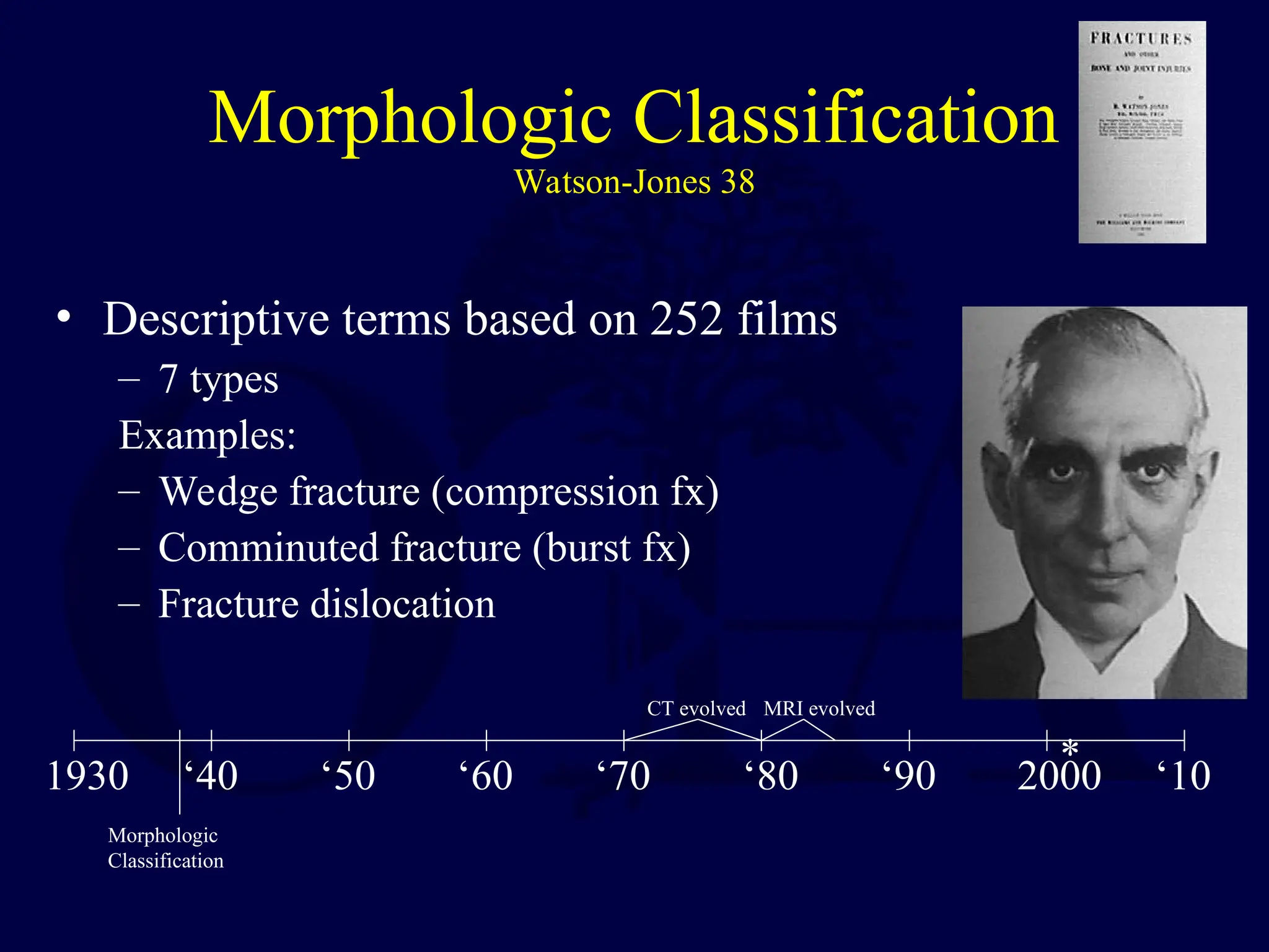 Morphologic Classification
Watson-Jones 38
• Descriptive terms based on 252 films
– 7 types
Examples:
– Wedge fracture (compression fx)
– Comminuted fracture (burst fx)
– Fracture dislocation
Morphologic
Classification
1930 ‘40 ‘50 ‘60 ‘70 ‘80 ‘90 2000 ‘10
CT evolved MRI evolved
*
 